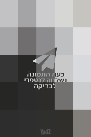 זוקפי גב