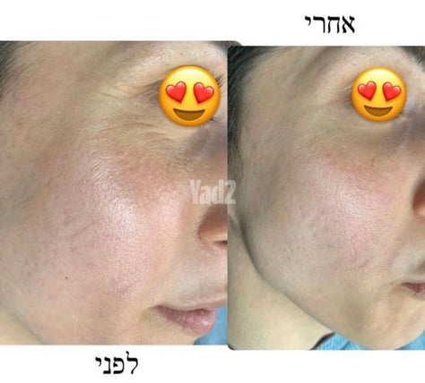מכשיר קוסמטי