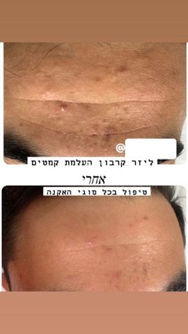 מכשיר קוסמטי