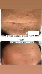מכשיר קוסמטי