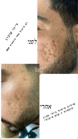 מכשיר קוסמטי