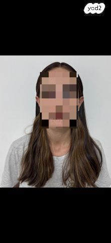 פאת פרונט לייס