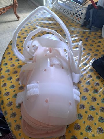 קיבוע ליד