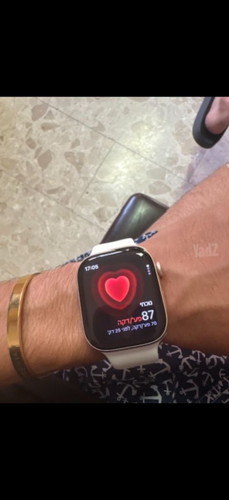 2 שעוני Apple Watch Series 10
