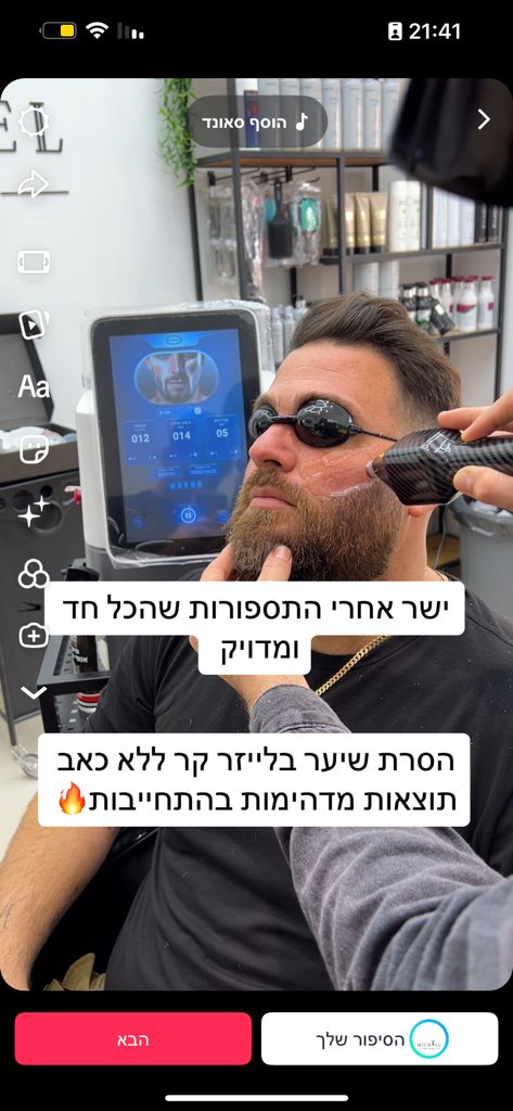 מכונת לייזר